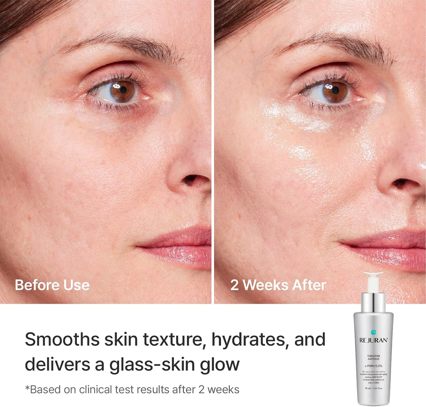 Rejuran Turnover Ampoule 30ml